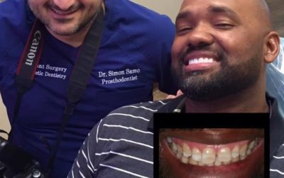 An Extreme Smile Makeover For The New Year | Houston, TX